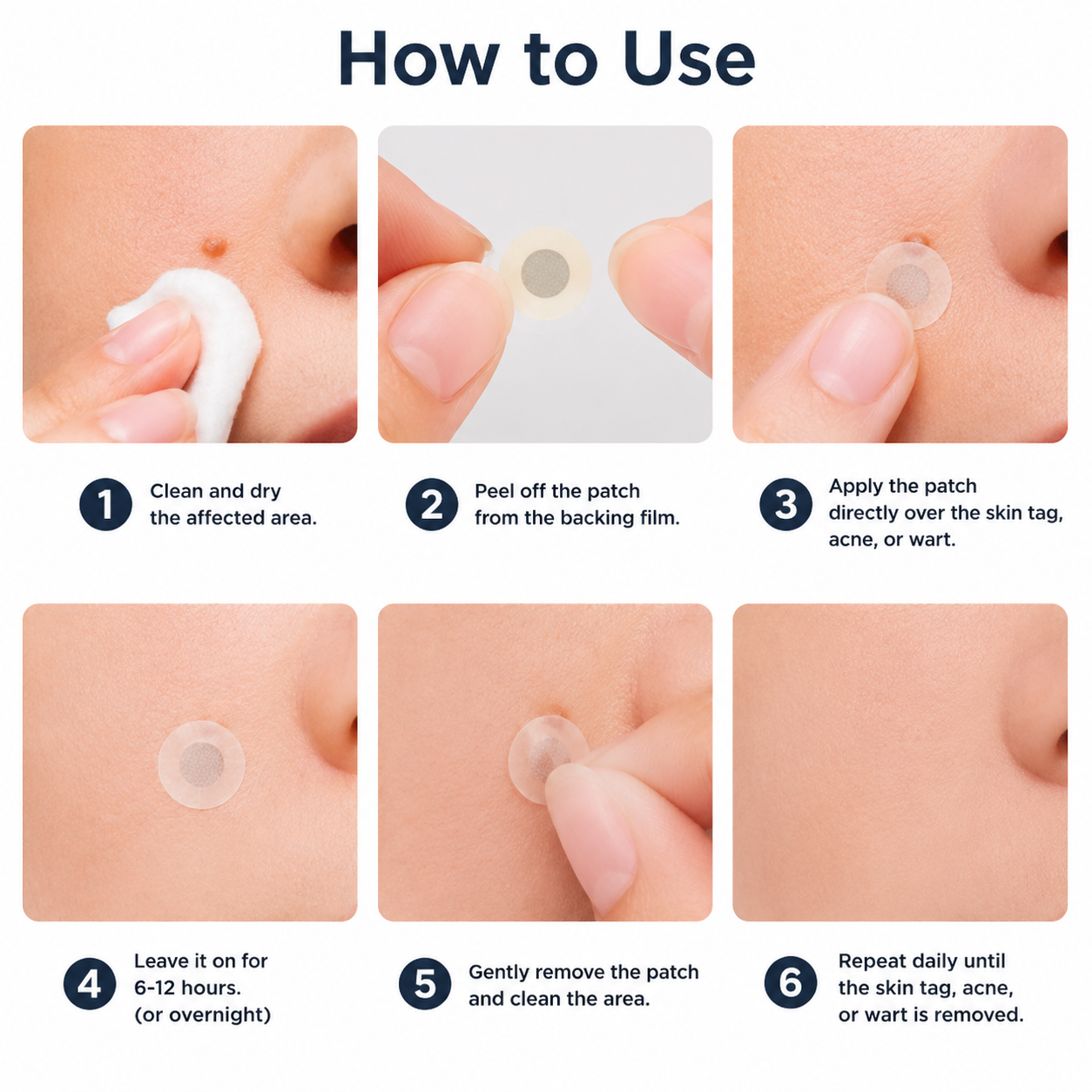 Finally A Simple Way To Address Common Skin Imperfections At Home