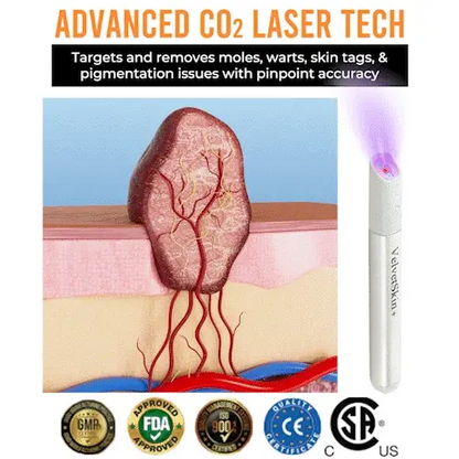 Xalnora™ All-in-One CO₂ Laser Eraser Pen | Removes Moles, Warts, Skin Flaws & Pigmentation