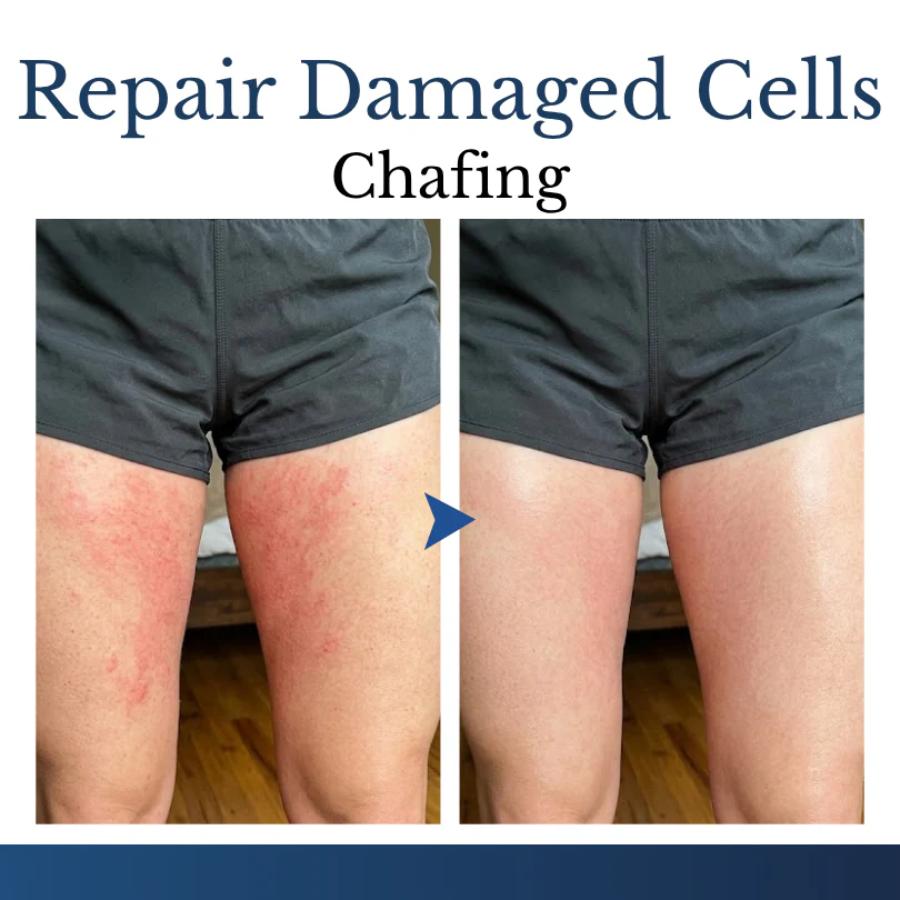 Finally A Simple Way To Address Common Skin Imperfections At Home