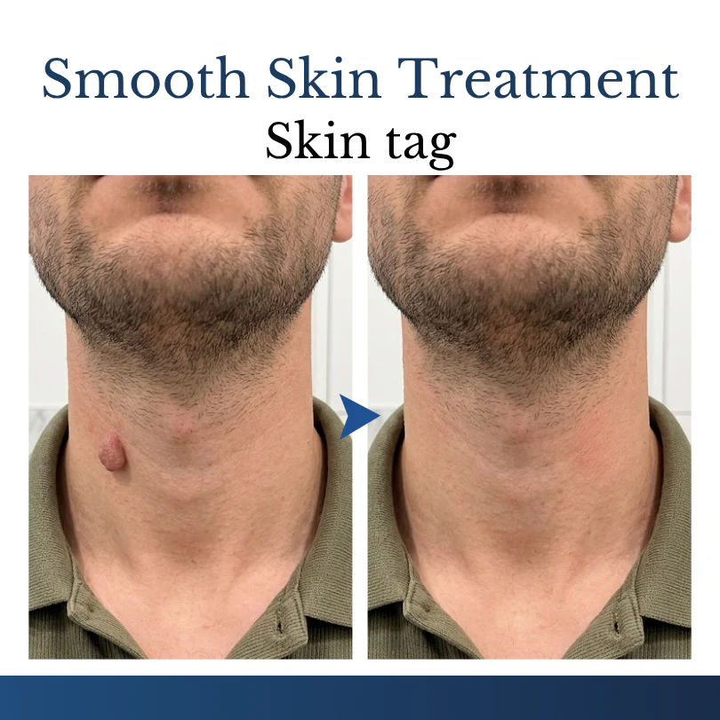 Finally A Simple Way To Address Common Skin Imperfections At Home