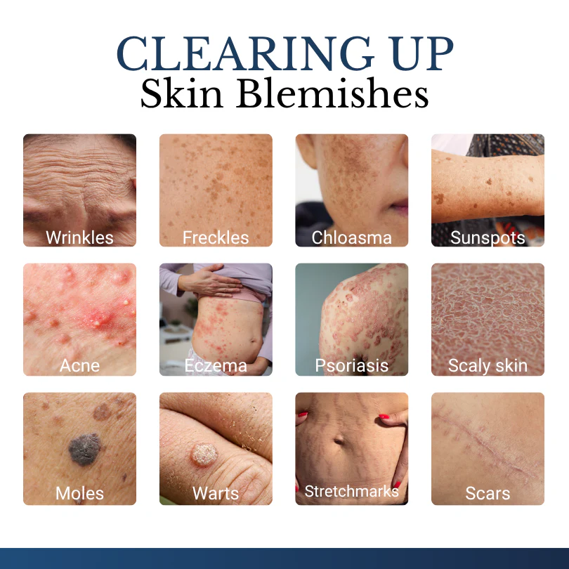 Finally A Simple Way To Address Common Skin Imperfections At Home