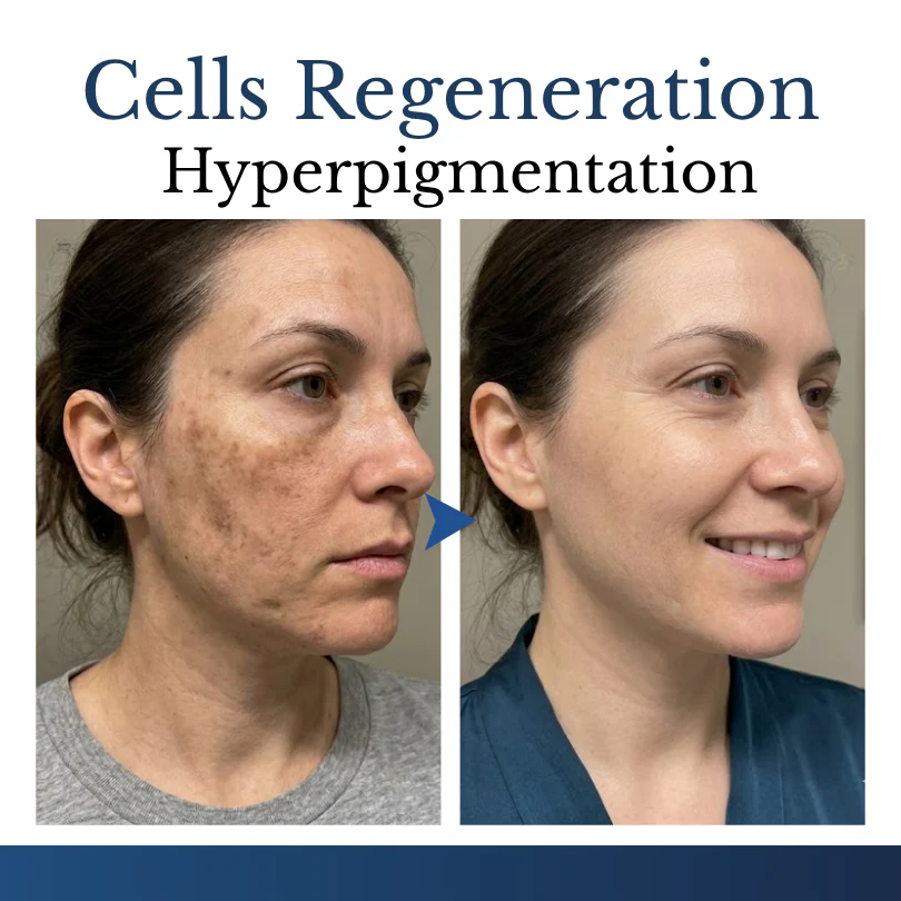 Finally A Simple Way To Address Common Skin Imperfections At Home