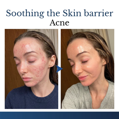 Finally A Simple Way To Address Common Skin Imperfections At Home
