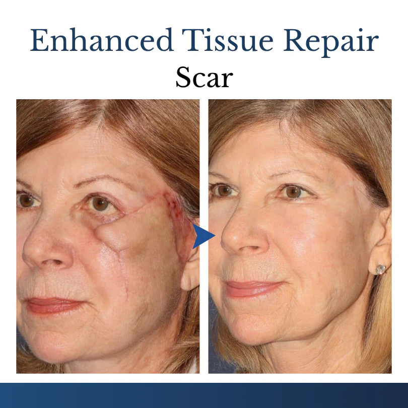 Finally A Simple Way To Address Common Skin Imperfections At Home