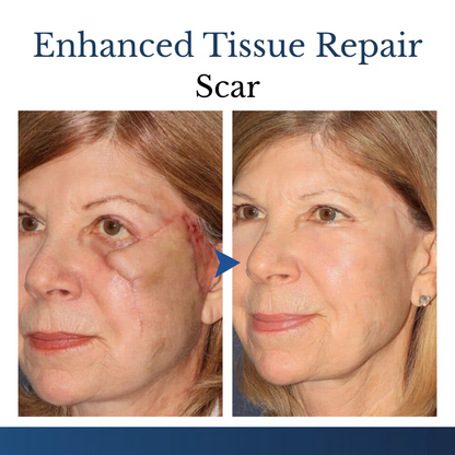 Finally A Simple Way To Address Common Skin Imperfections At Home